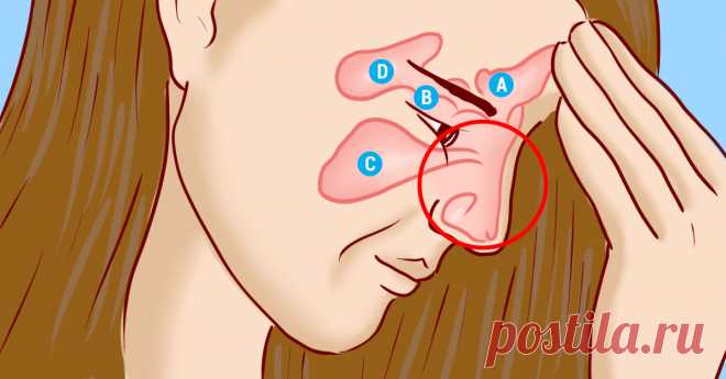 Избавься от инфекции носовых пазух всего за 5 минут! Знать бы этот метод раньше... Всё для легкого дыхания.