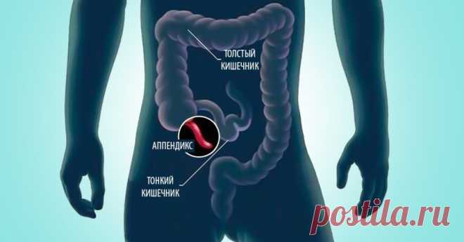 Основные симптомы аппендицита – пять основных проявлений аппендикса. Какие симптомы наиболее характерны для аппендицита – 5 основных клинических проявлений этого заболевания (видео от хирурга, фото)