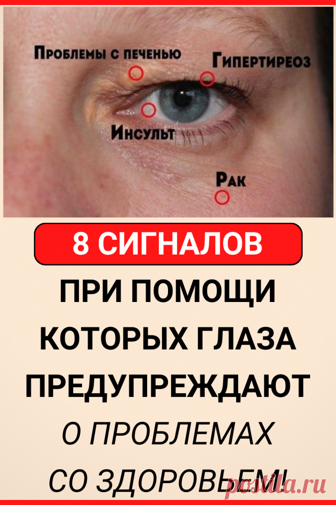 8 сигналов, при помощи которых глаза предупреждают о проблемах со здоровьем! Обрати внимание!
#здоровье #глаза #зрение #диагностика #симптомы