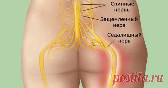 Попрощайтесь с болью в спине! Достижение успеха в 95 % случаев!