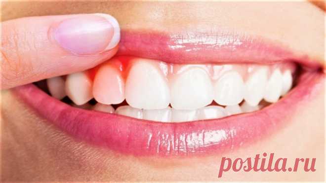 8 народных методов от зубной боли.