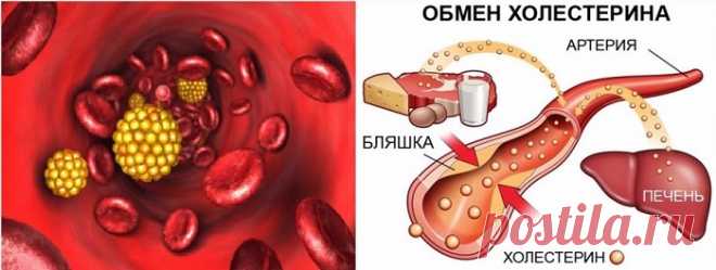 Народные средства для снижения холестерина