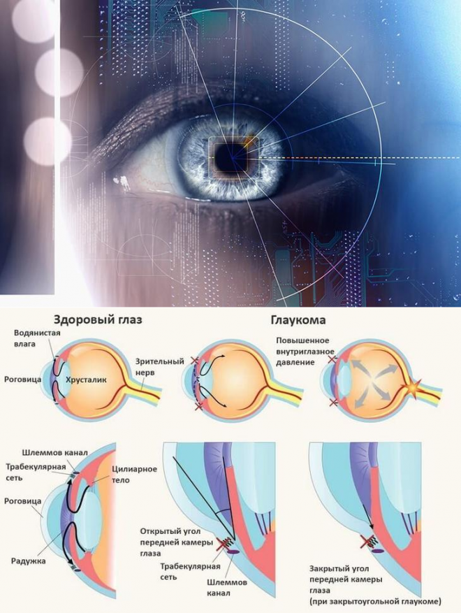 Водянистая влага передней камеры глаза. Зрение при глаукоме. Глаукома строение глаза.