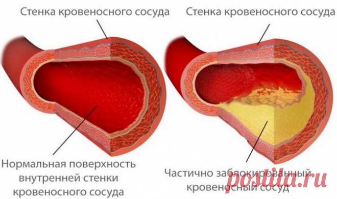 Проверенные народные способы очищения сосудов головного мозга Каждый человек, желающий прожить долгую активную жизнь без болезней, должен помнить, что здоровье — бесценный дар, заботиться о котором необходимо не от случая к случаю и не только тогда, когда дали о себе знать первые признаки болезни, но и каждый день. Проблемы мы создаем себе сами из-за того, что не бережем здоровье, данное нам природой. […]