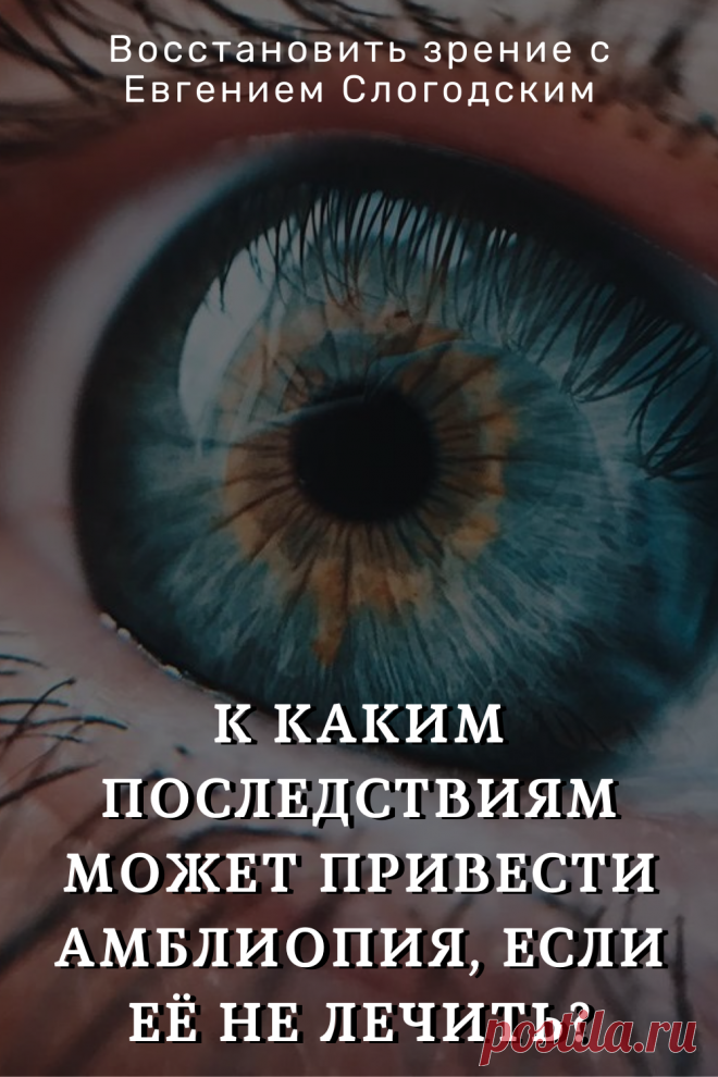 Амблиопия Синдром ленивого глаза Восстановление улучшение исправление зрения Эффективное лечение амблиопии симптомы причины диагностика степени Безоперационная коррекция зрения Упражнения гимнастика при амблиопии тренажёр для глаз Профилактика Почему портится зрение что делать методы лечения очки Амблиопия у детей Хорошее зрение Глазные болезни Здоровье глаз Как сохранить зрение без операции Заболевания глаз Ухудшение нарушение зрения Как проверить и как лечить амблиопию у детей взрослых