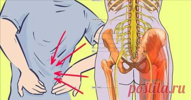 Попрощайся с седалищной невралгией за 10 минут