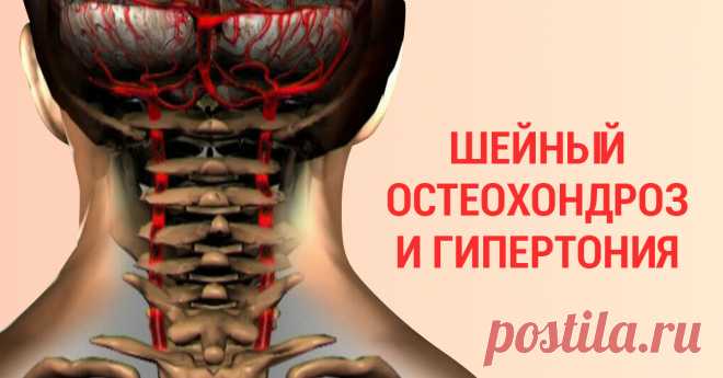 90 % трудоспособного населения страдает от шейного остеохондроза... Останови этот замкнутый круг! Болезнь обнаруживается даже в молодом возрасте.