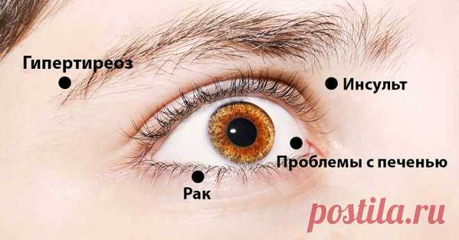 8 сигналов, при помощи которых глаза предупреждают о проблемах со здоровьем - МирТесен