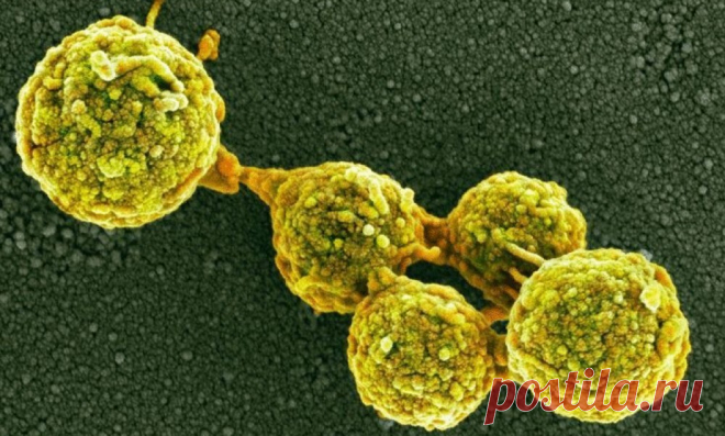 Причина рака - грибы, которык нас едят 
Врач-лаборант клиники УВД города Белгорода Лидия Васильевна Козьмина. Людей едят грибы. Такой жуткий вывод сделала врач-лаборант с университетским образованием, которая четверть века рассм…