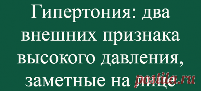 Гипертония: два внешних признака высокого давления, заметные на лице
Одним из внешних признаков высокого артериального давления, свойственного гипертонии, является покраснение лица. Наблюдаемое при гипертонии высокое кровяное давление говорит о повышенном напряжении, испытываемом сосудами под действием идущей через них крови. Также оно отражает интенсивность работы сердца по перекачке крови. Чем...
Читай дальше на сайте. Жми подробнее ➡