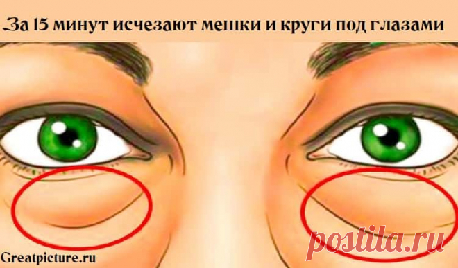 За 15 минут исчезают мешки и круги под глазами.Это супер-продукт! За 15 минут исчезают мешки и круги под глазами.Это супер-продукт!Знаменитый визажист Ариана Пул работает со звёздами такой величины