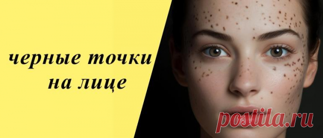 Эффективные способы избавиться от черных точек на лице Простые и эффективные способы борьбы с черными точками на лице. Советы по уходу за кожей и домашние рецепты для чистой и здоровой кожи.