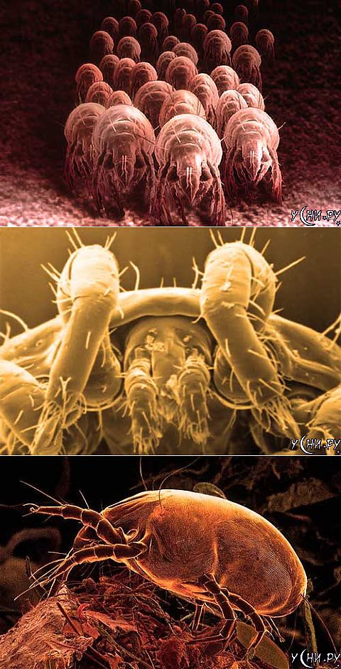 Против пылевого клеща. Сапрофиты пылевые клещи. Пылевые клещи под микроскопом. Пылевой клещ под микроскопом.